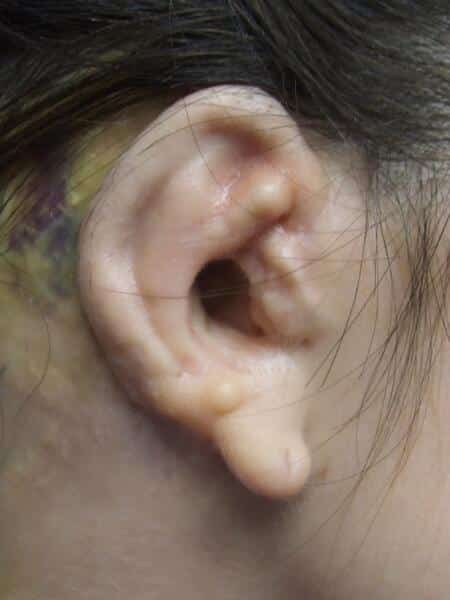 A person 's ear with an arrow on it.