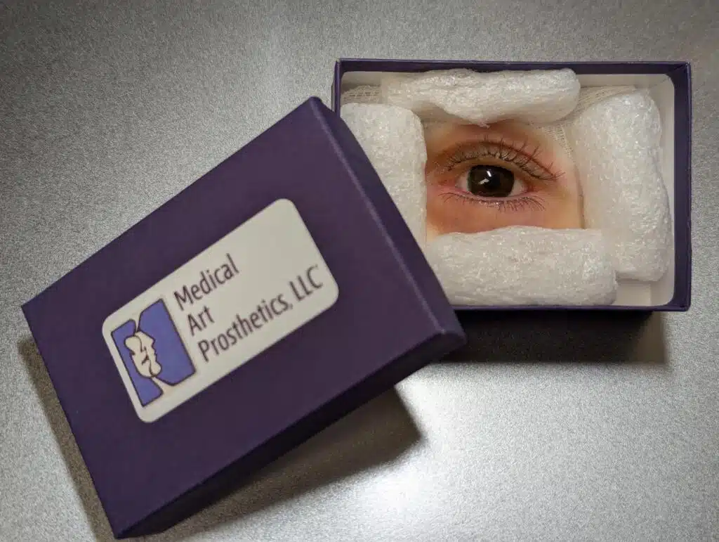 orbital anaplastology prosthesis in box