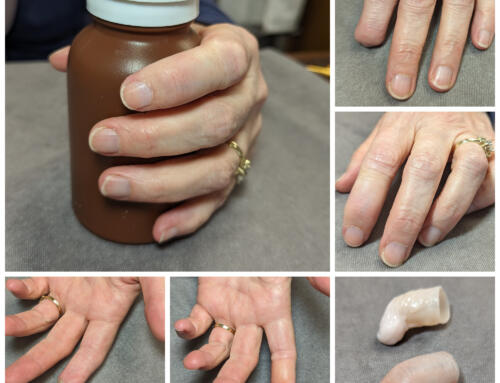 Prosthetic Fingertip for Viola Musician