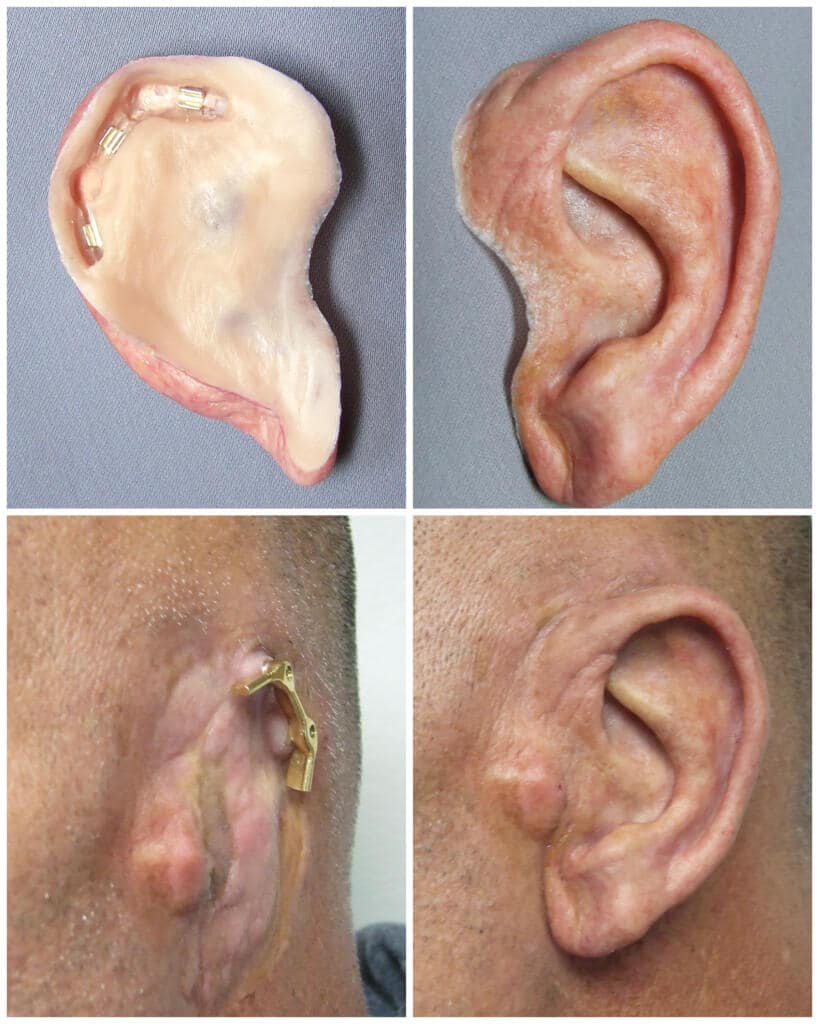 A picture of an ear with different parts.