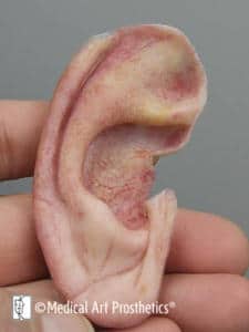 A person holding an ear with one ear missing.