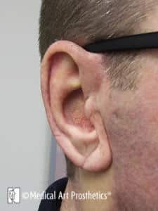 A man with glasses is wearing an ear.