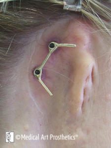 A woman 's ear with two piercings in it.