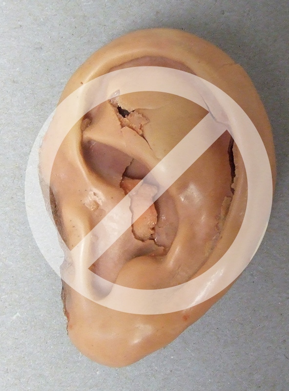 Image of cracked plastic looking ear prosthesis