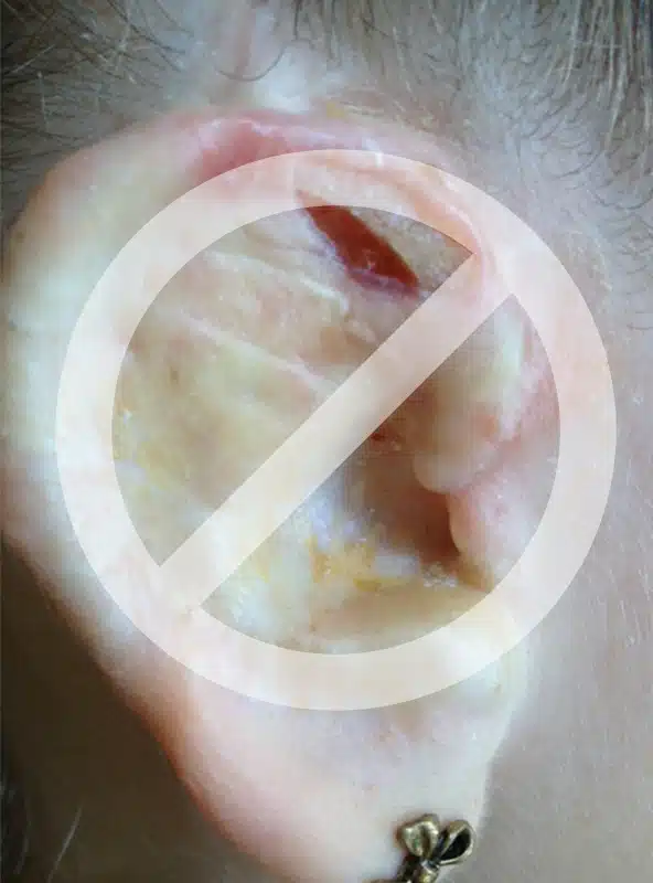 A close up of an ear with a no sign on it