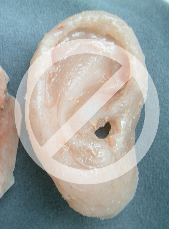 Photo of ear prosthesis with delaminating finish and artificial appearance