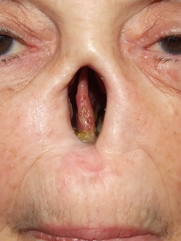 nose nasal