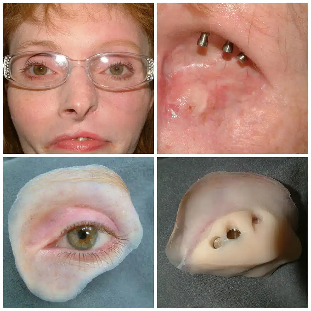 A woman with glasses and a nose piercing.
