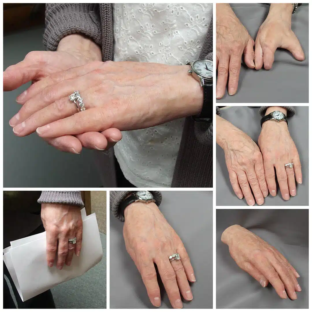 A man with his hands and wedding ring.