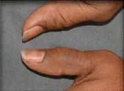 A person with their fingers crossed for something.