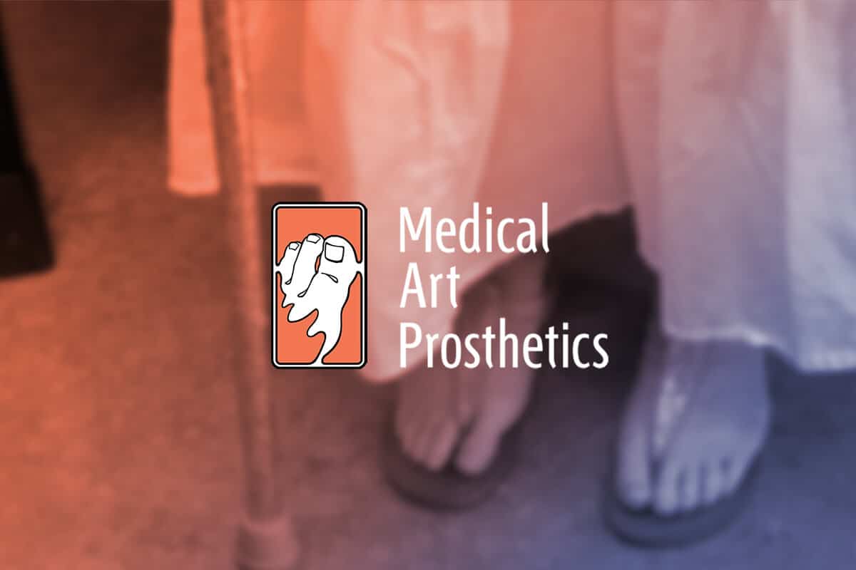 Toe Prosthesis  Milwaukee — Life-like Prosthetics
