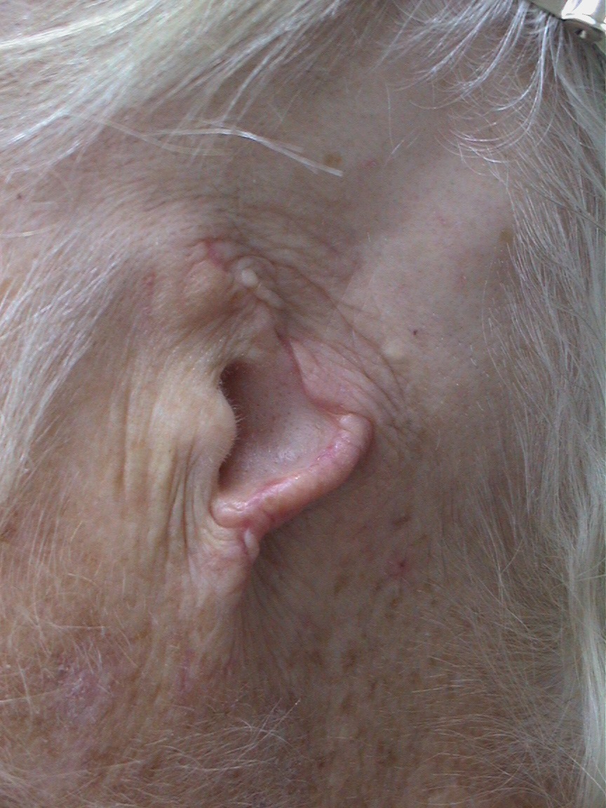 A close up of an older person 's ear