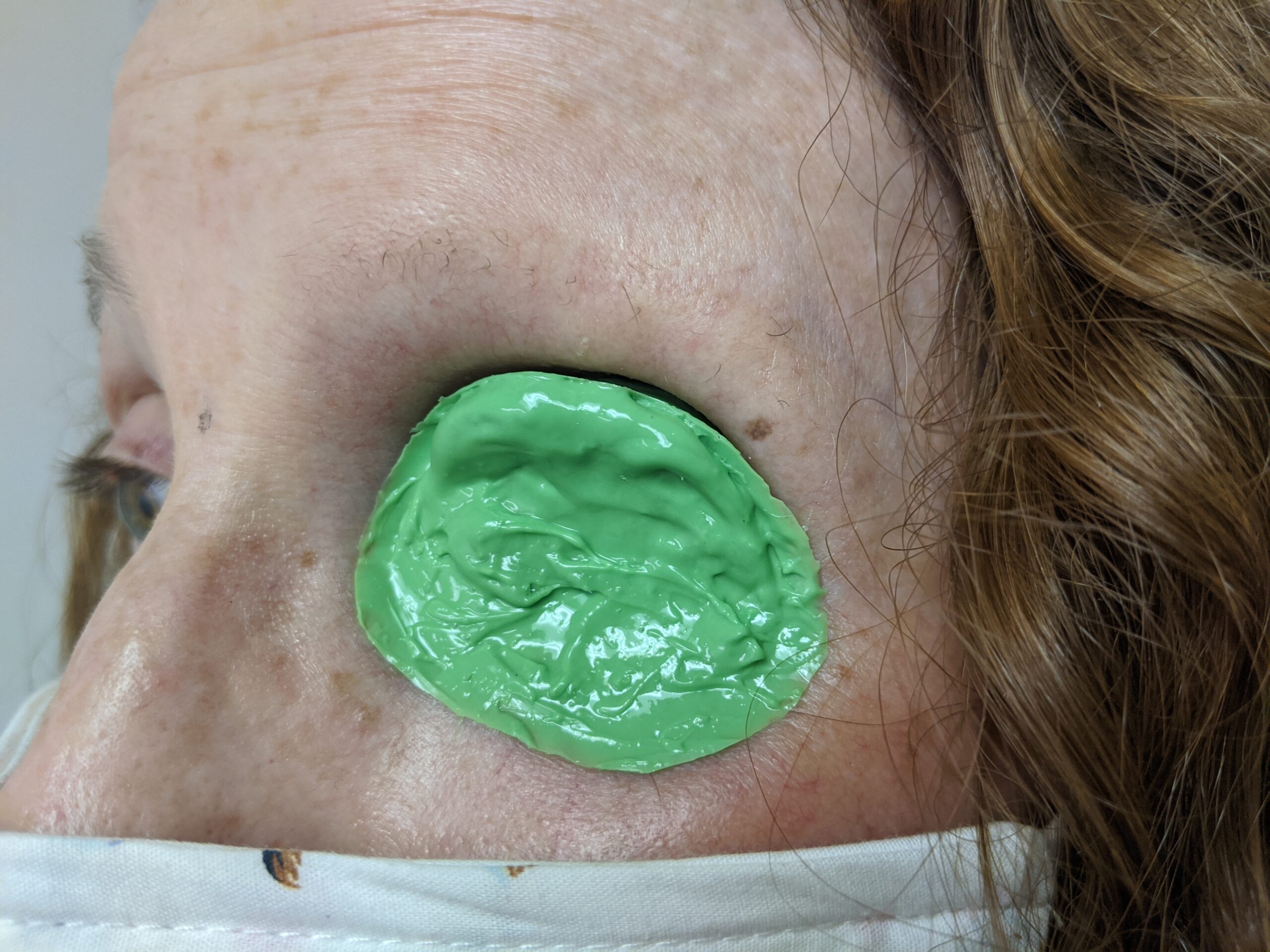 Impression and fitting session