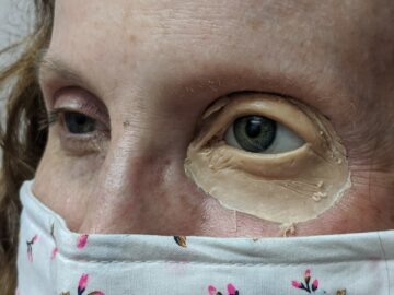 Artificial eye positioning and sculpting