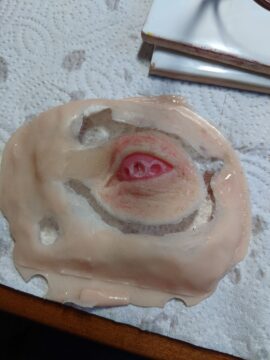 Demolding of silicone orbital