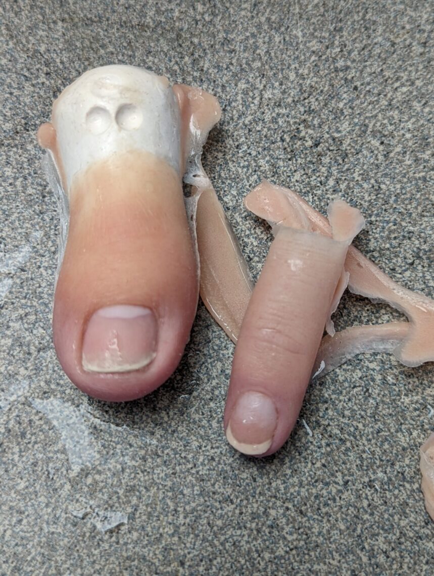 silicone toe prosthetics pictures