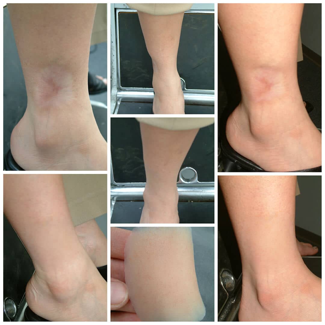 A collage of pictures showing the different stages of swelling.