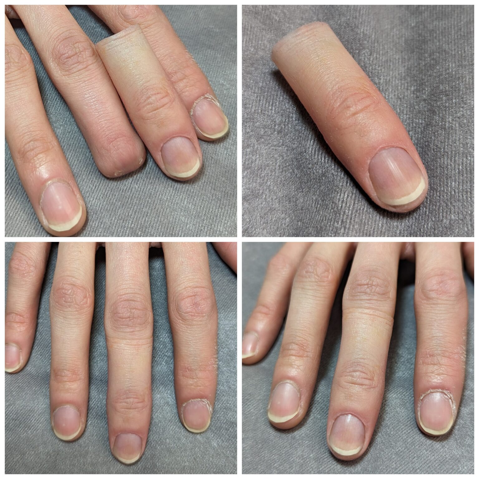 a collage of a person's hand