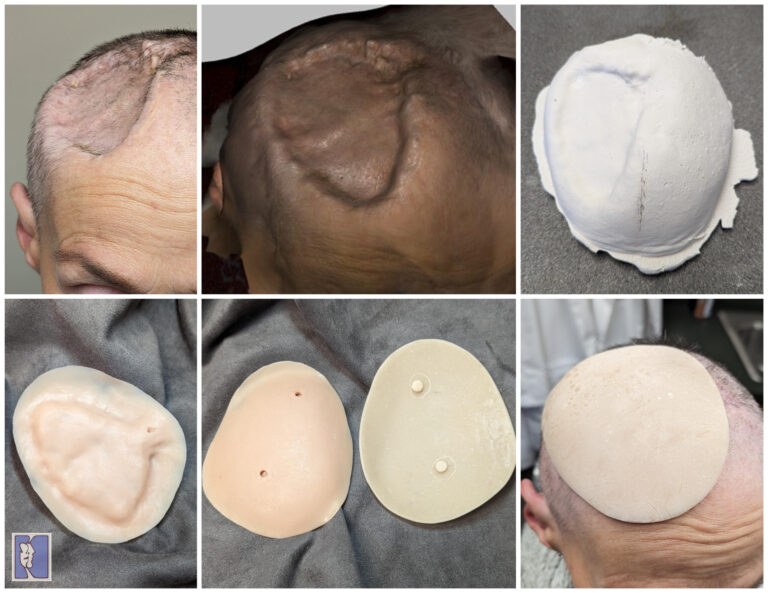 a collage of images of a man's head
