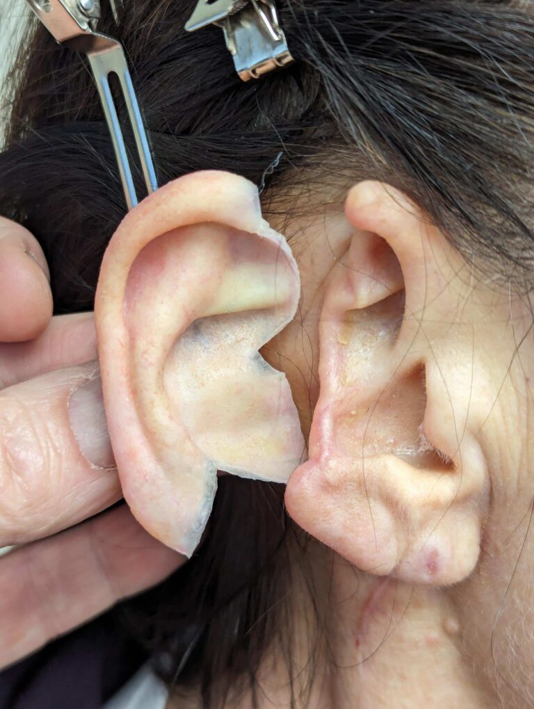 a person removing a pair of ear