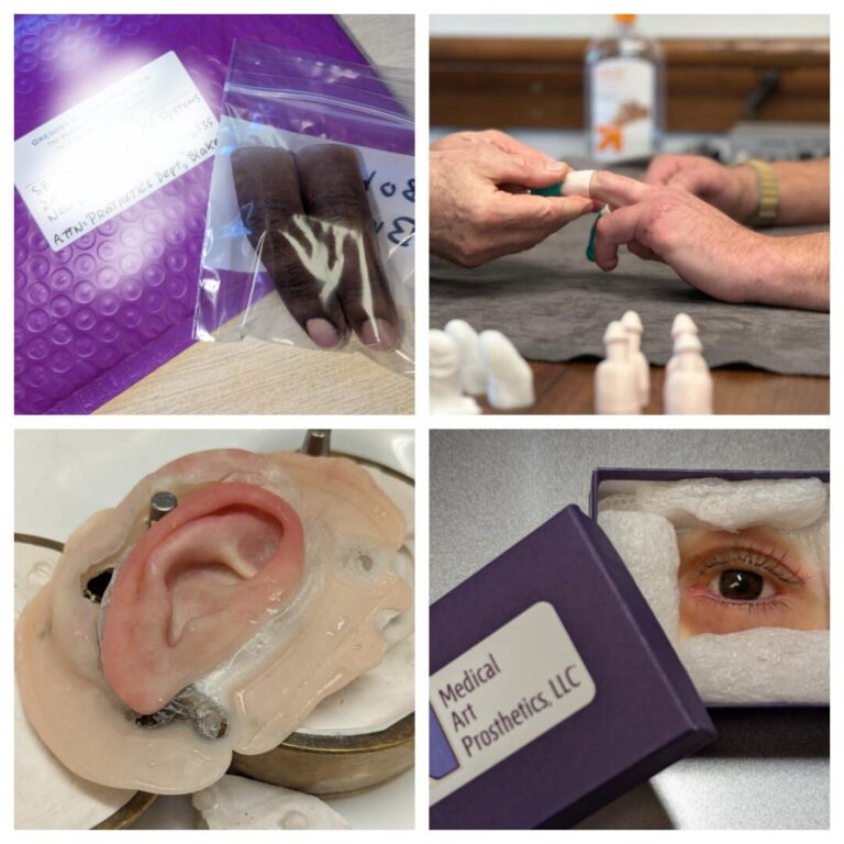 a collage of medical equipment