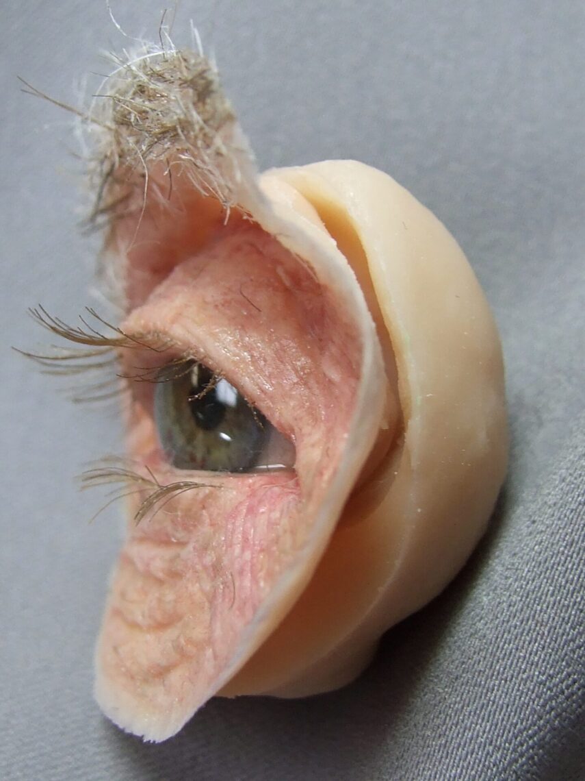 magnetic retention of oculofacial prosthetics