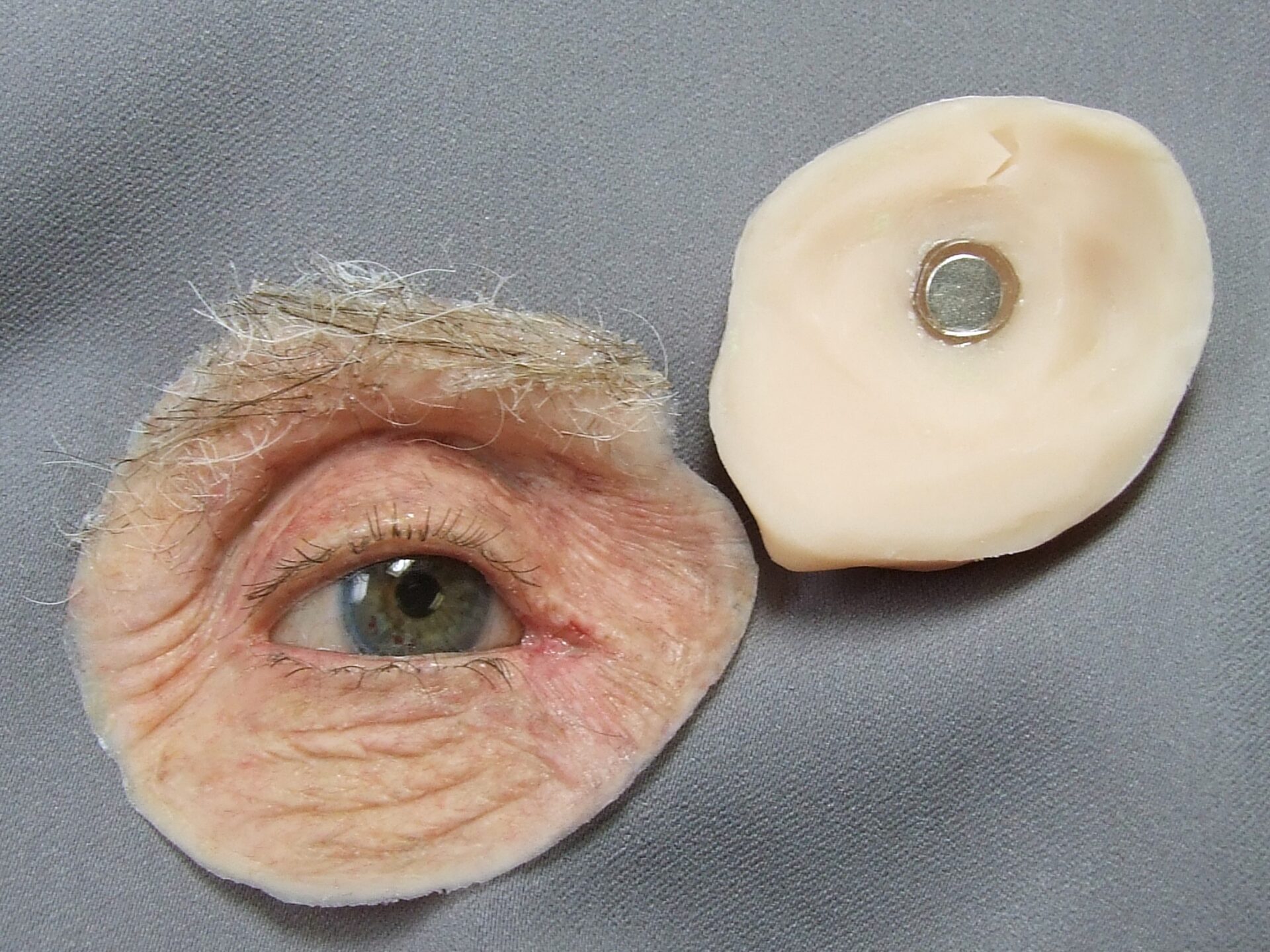 magnetic orbital prosthesis with ocular