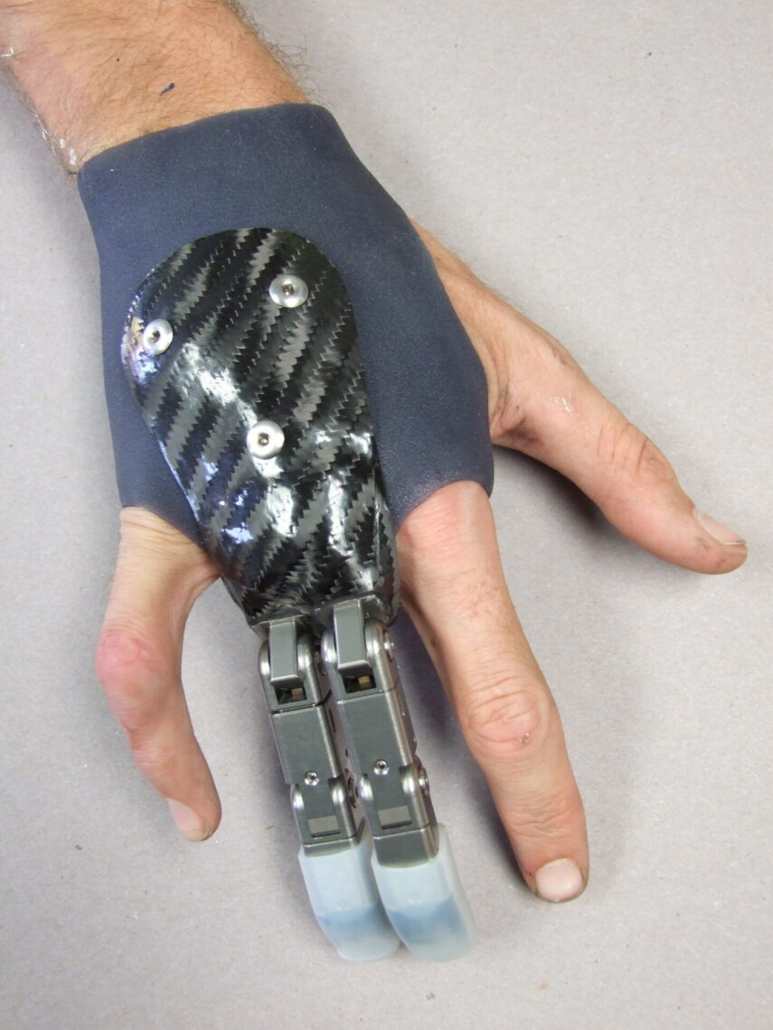 man's hand with ratcheting prosthetic fingers