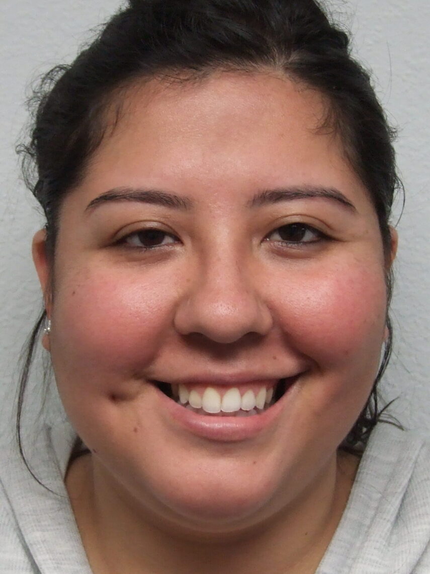 happy post-prosthetic ear procedure