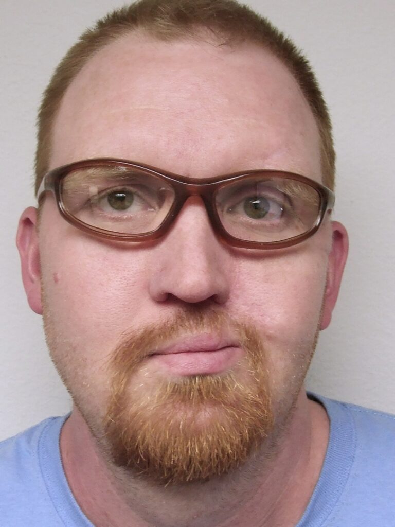 Man wearing prosthetic nose