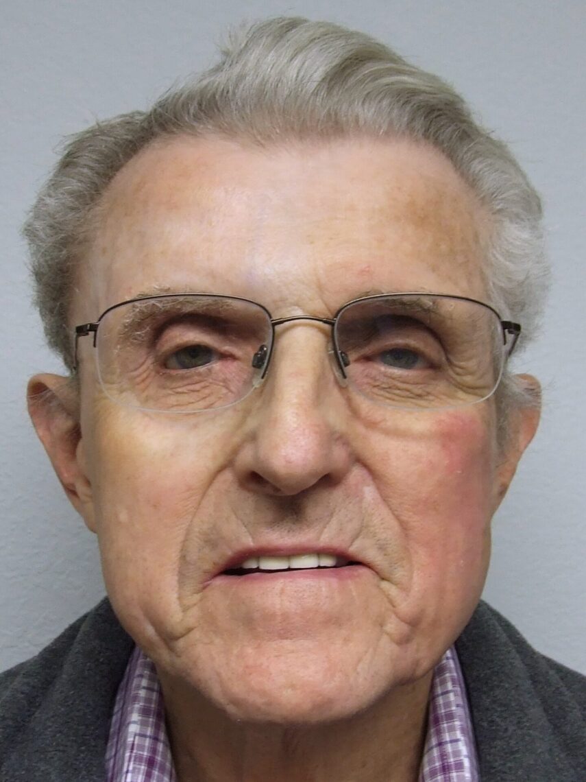 magnetic orbital prosthesis results