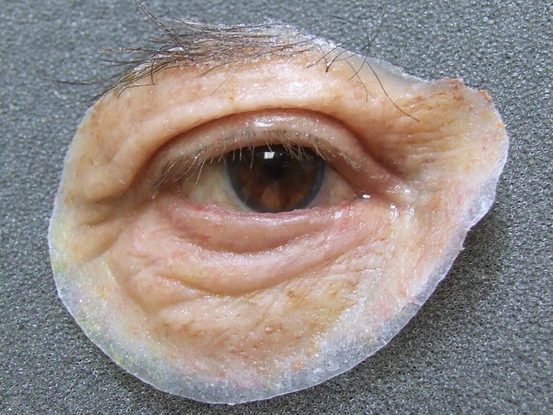 artificial eye in silicone prosthesis