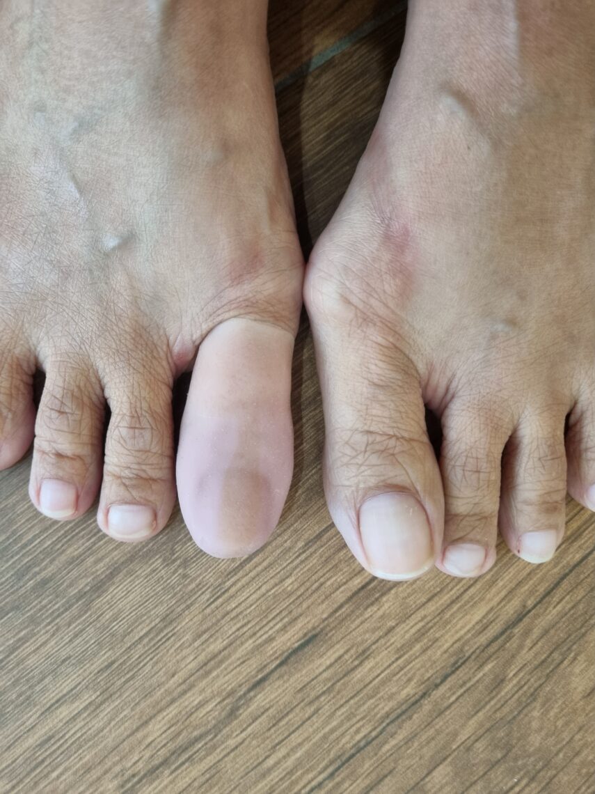 silicone check socket