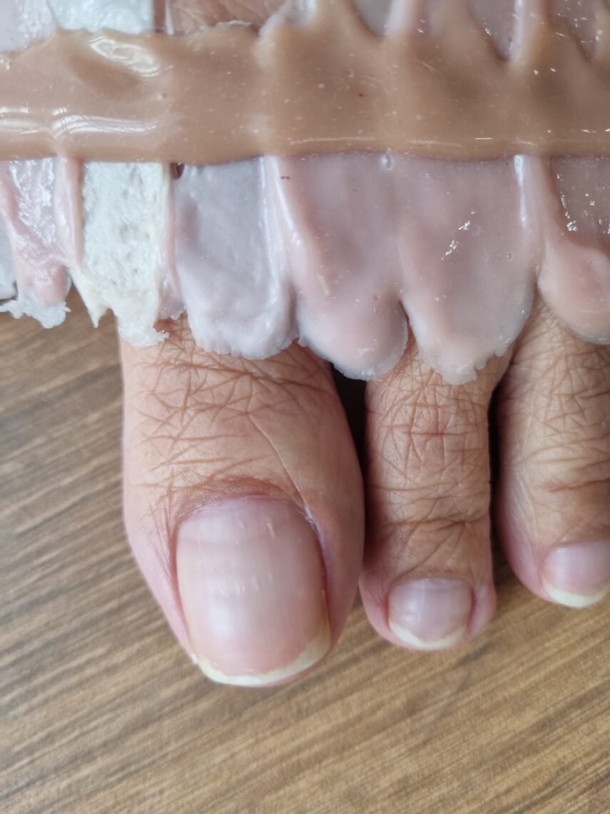 perfect color matching of toe prosthesis