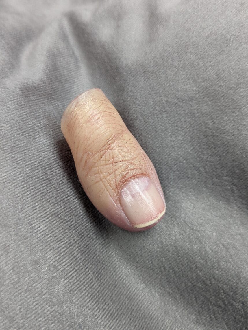 highly detailed silicone toe prosthesis