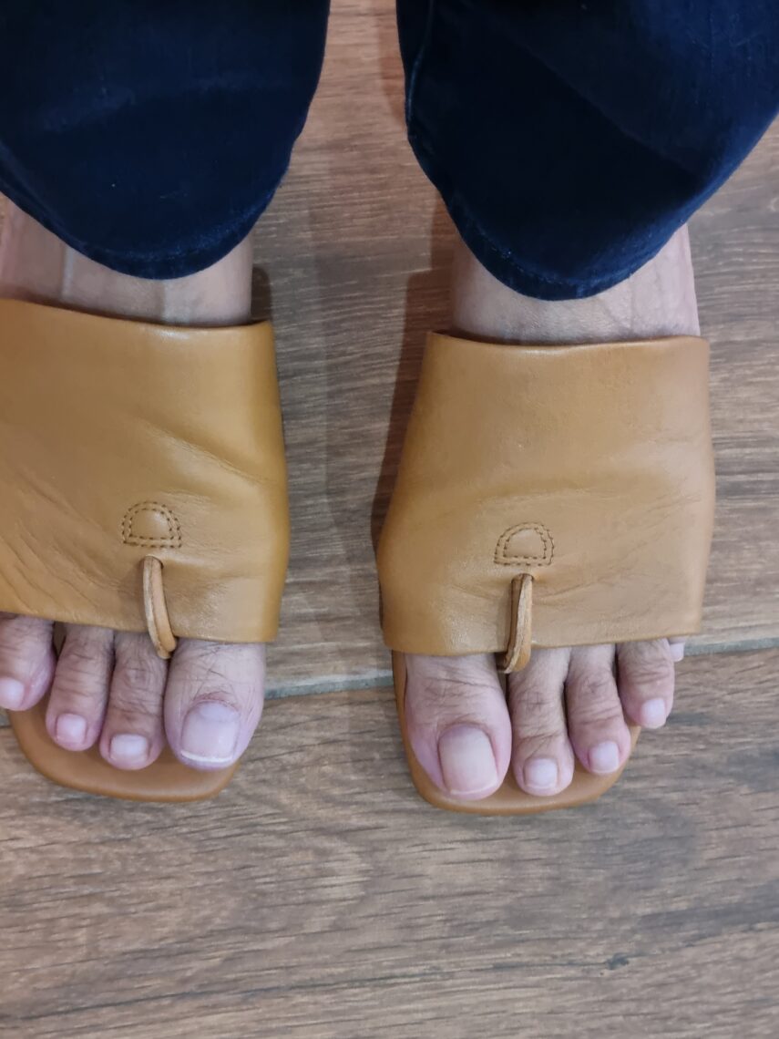 convincingly real toe prosthetic result