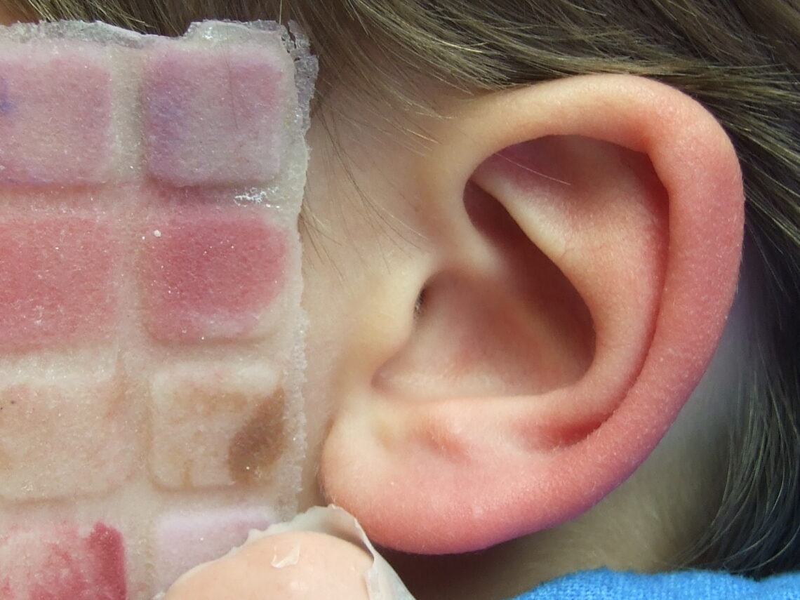 ear prosthesis color matching session