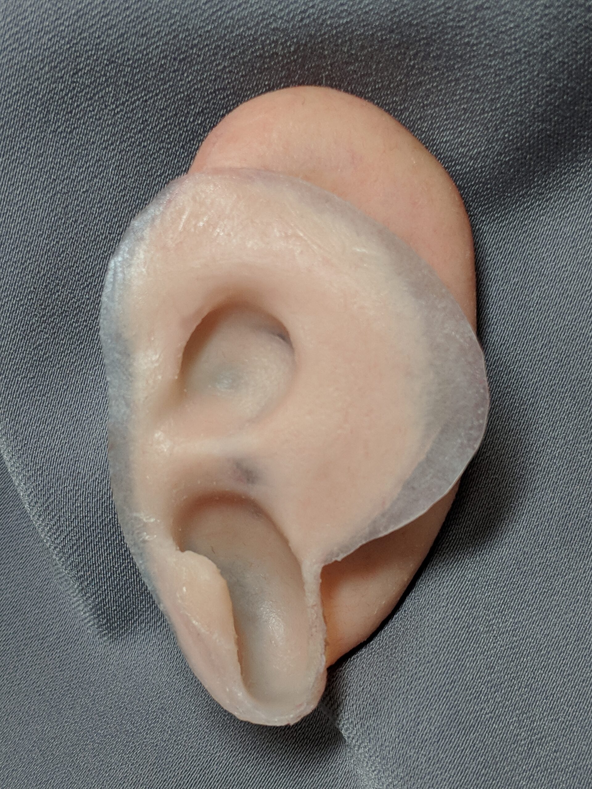 inside surface of prosthetic ear