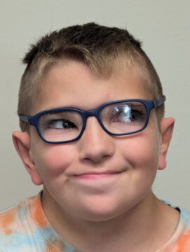 photo of young boy happy with new ears