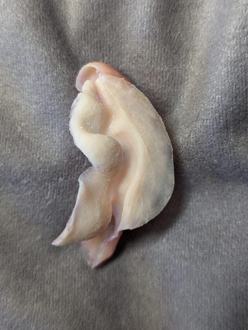 partial ear prosthesis back