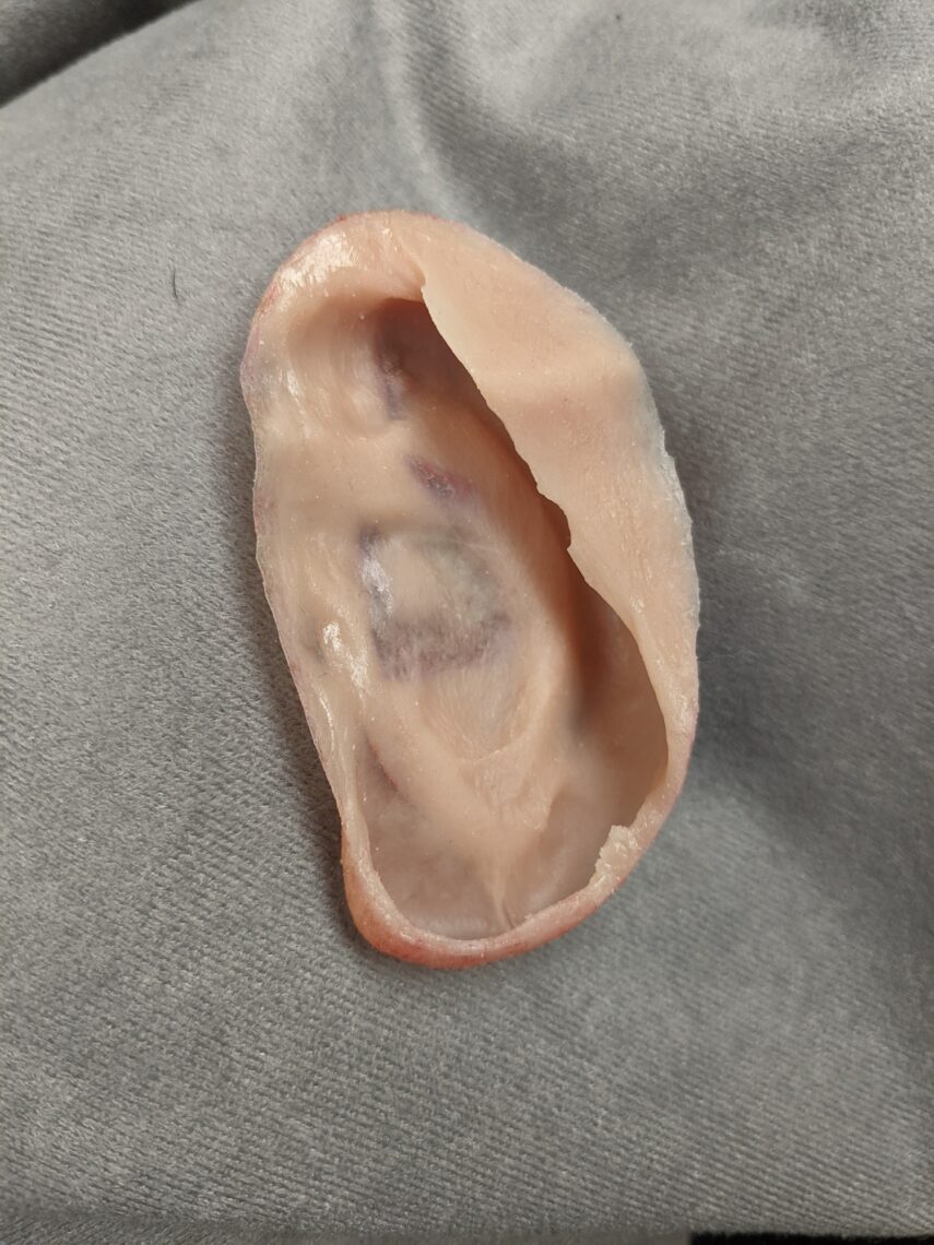 inside of prosthetic ear that fits over ear reconstruction