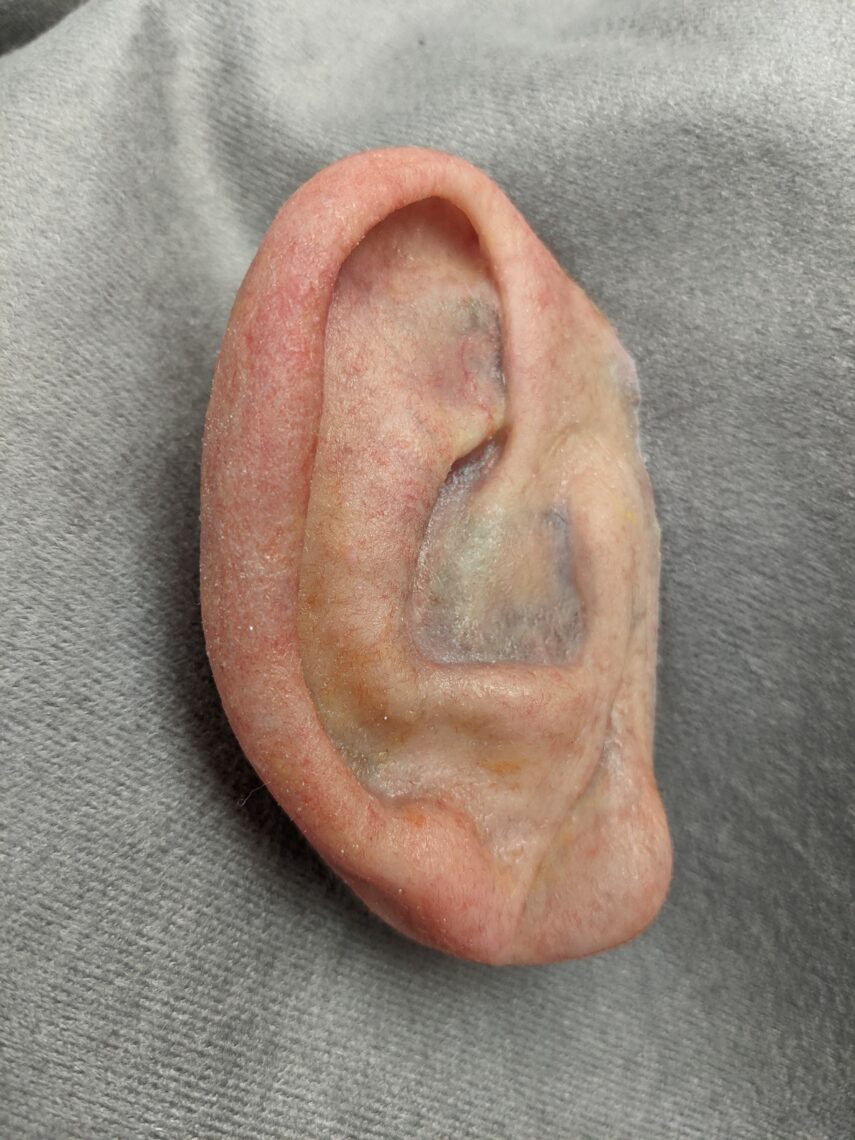 highly detailed ear prosthesis