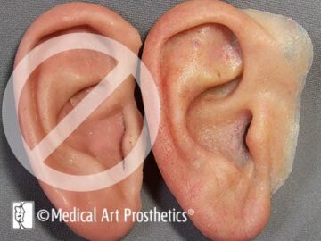 Monochromatic ear compared to highly detailed ear prosthesis