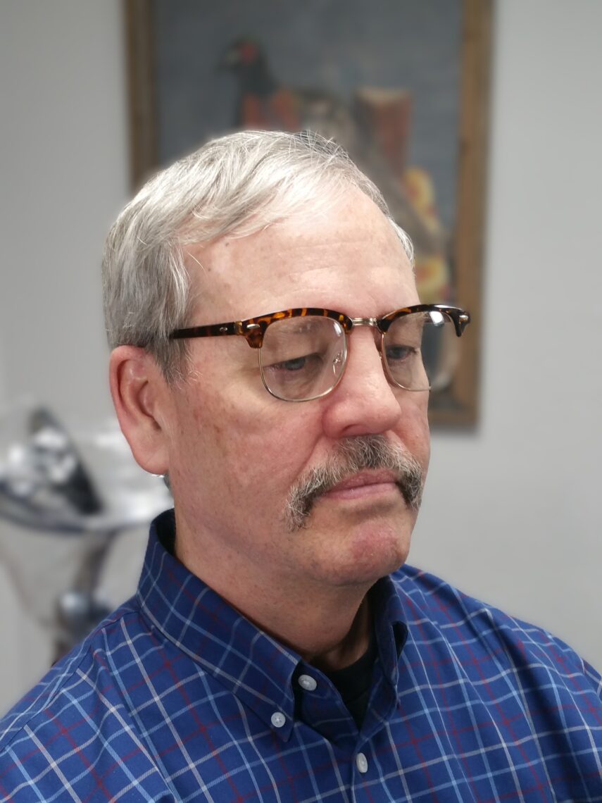 excellent nasal prosthetic attached on man with osseointegrated implants