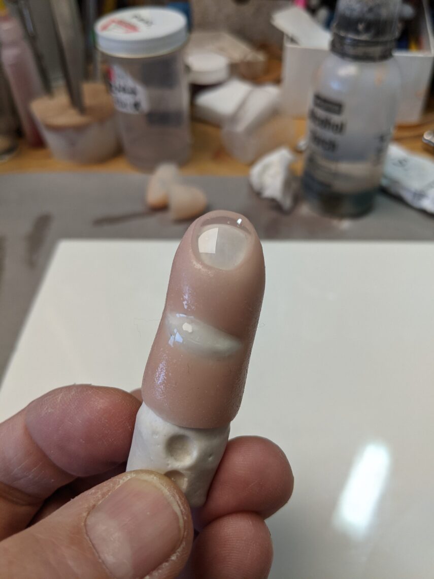 photo offinger prosthetic for playing guitar