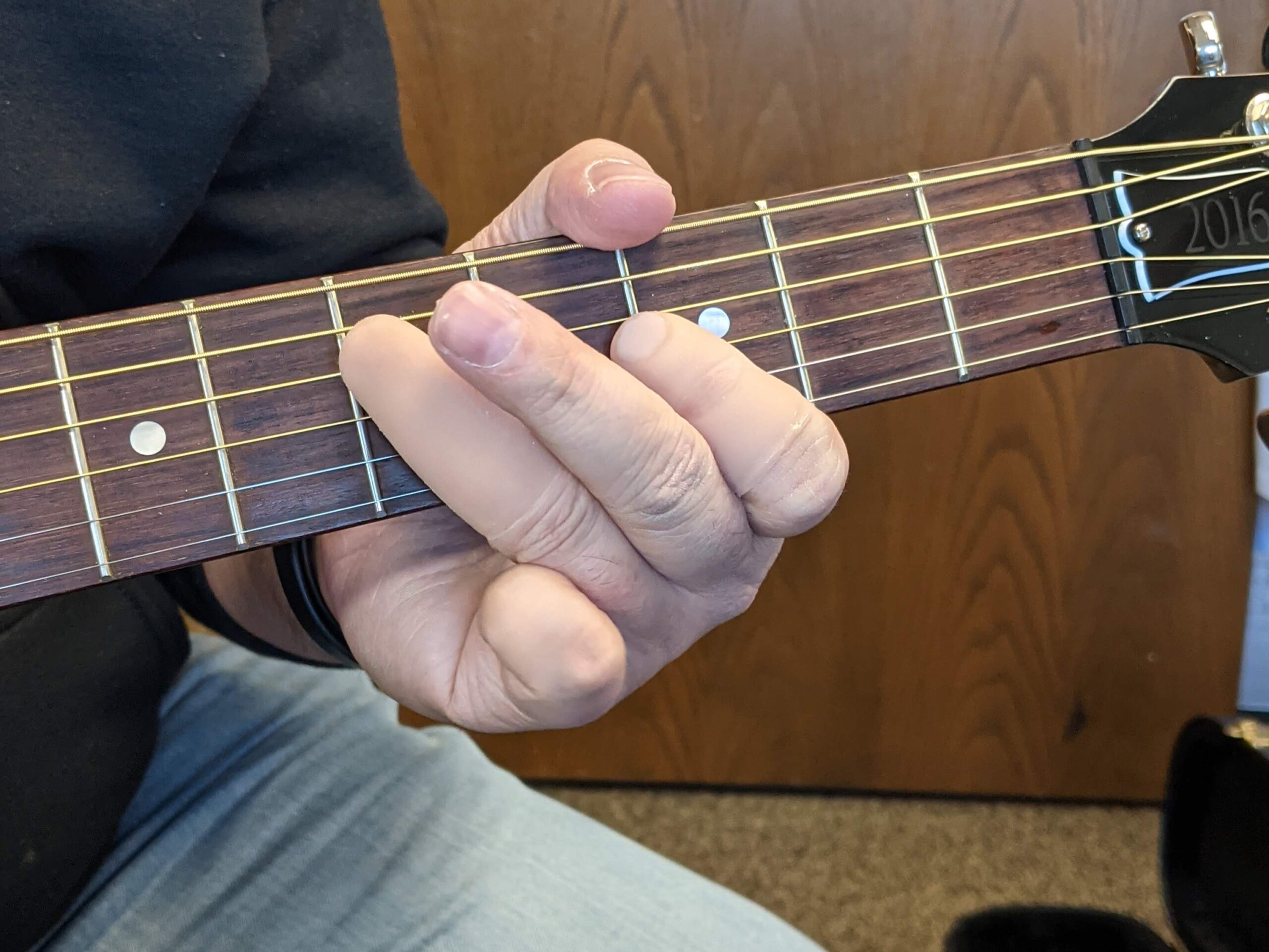 Man playing guitar with prosthetic fingers