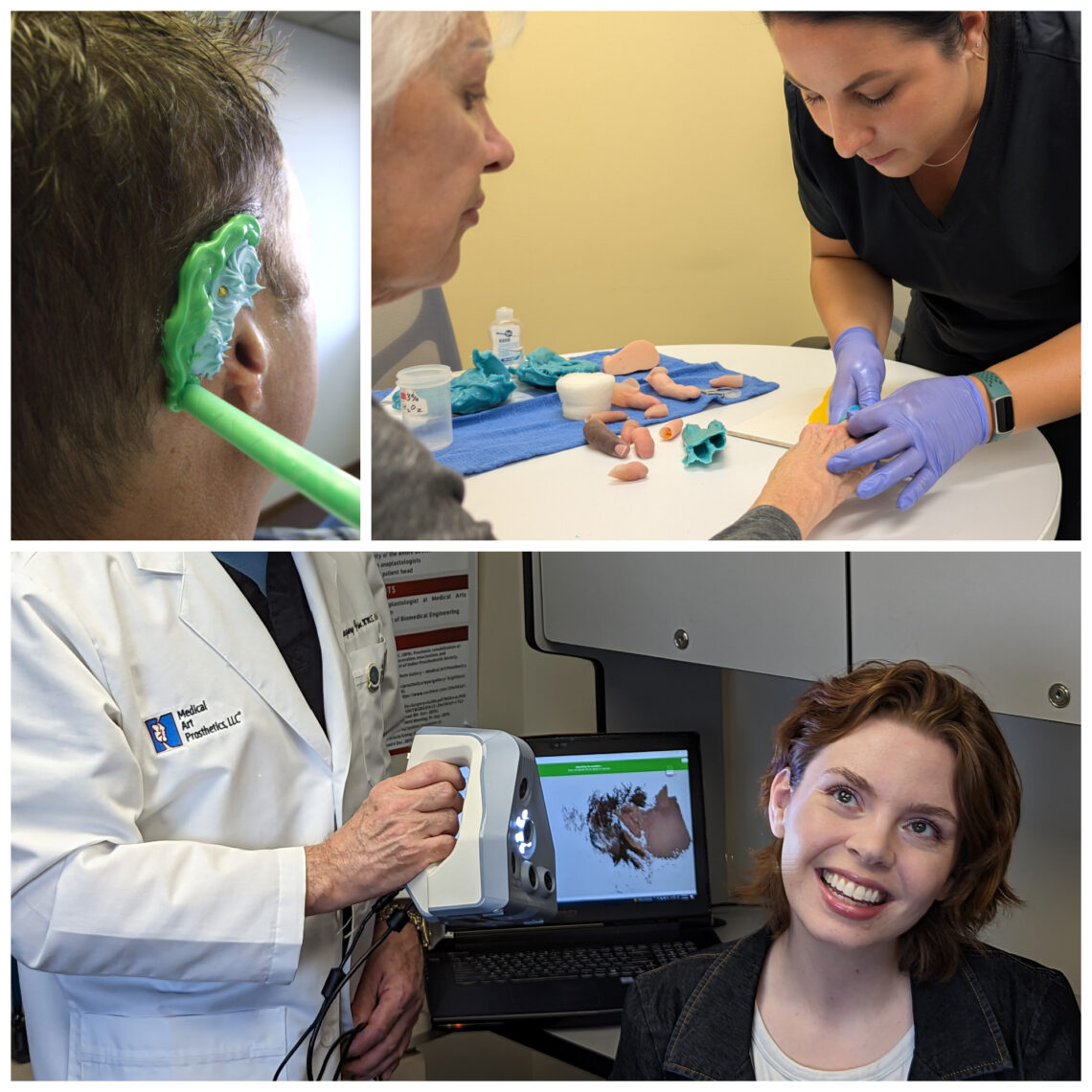 showing how prosthetics get started with impression techniques