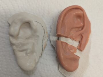 Adjustment in wax to accomodate the ear growth