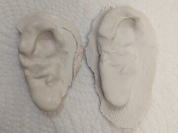 ear prosthesis plaster molds