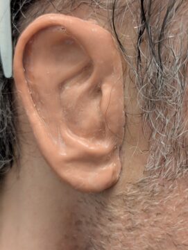wax prototype for ear prosthesis 